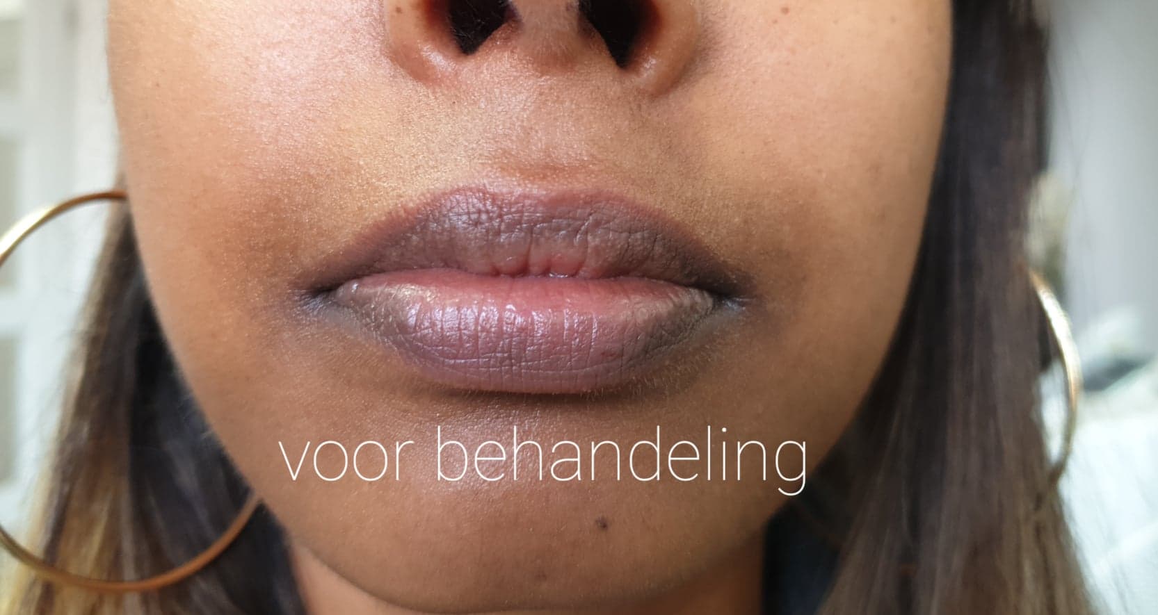 Beautysalon en Permanente makeup Alicia Donkere lippen oplichten ( Neutralisatie)